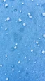 Placeholder: frost texture background