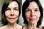 Placeholder: A selfie of a brunette woman, middle short hair, showing a 39-year-old European woman. She has white skin, tousled brown hair, face without makeup, big round dark brown eyes, cute nose, detailed full lips, skin texture. Split screen and show the same face but 15 years older