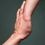 Placeholder: the back of a swollen right hand