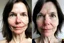 Placeholder: A selfie of a brunette woman, middle short hair, showing a 44-year-old European woman. She has white skin, tousled brown hair, face without makeup, big round dark brown eyes, cute nose, detailed full lips, skin texture. Split screen and show the same face but 15 years older