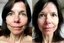 Placeholder: A selfie of a brunette woman, middle short hair, showing a 37-year-old European woman. She has white skin, tousled brown hair, face without makeup, big round dark brown eyes, cute profiled nose, detailed full lips, skin texture. Split screen and show the same face but 15 years older