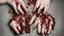 Placeholder: a woman's palms of her hands with dried and caked on blood all over them