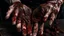 Placeholder: a woman's palms of her hands with dried and caked on blood all over them