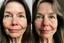 Placeholder: A selfie of a brunette woman, middle long hair, showing a 59-year-old European woman. She has brown hair, face without makeup, cute nose, detailed full lips, skin texture. Split screen and show on the right side the same face but without wrinkels and 15 years younger and more beautiful