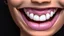 Placeholder: smiling emoji with big grin showing teeth, close up shot