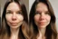 Placeholder: A selfie of a brunette woman, middle long hair, showing a 29-year-old European woman. She has brown hair, face without makeup, cute nose, detailed full lips, skin texture. Split screen and show the same face but without wrinkels and younger .