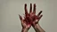 Placeholder: a woman's bloody palms of her hands