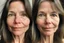 Placeholder: A selfie of a brunette woman, middle long hair, showing a 59-year-old European woman. She has brown hair, face without makeup, cute nose, detailed full lips, skin texture. Split screen and show on the right side the same face but without wrinkels and younger and more beautiful