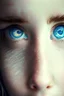 Placeholder: heterochromia eyes