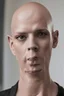 Placeholder: Shaved completely bald