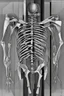 Placeholder: Cubist x-ray ribcage